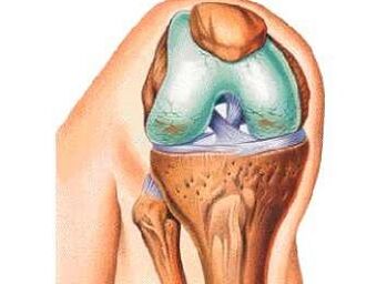 Las principales causas de la artrosis de la rodilla