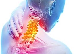 Síntomas de osteocondrosis cervical y reglas de nutrición para la enfermedad