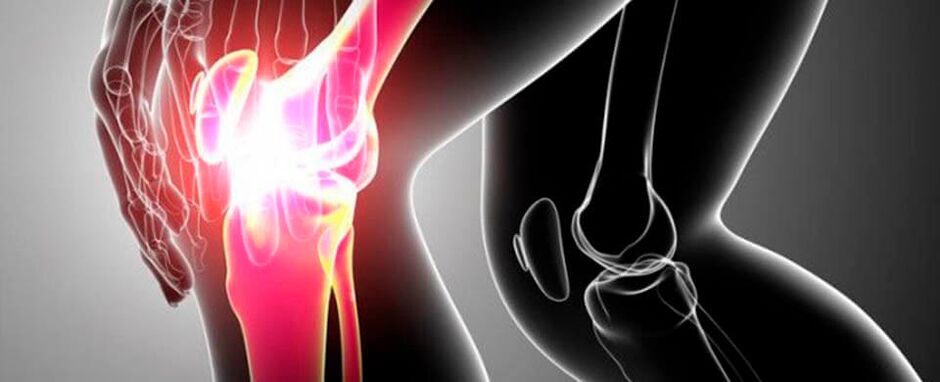 dolor en la articulación de la rodilla foto 4