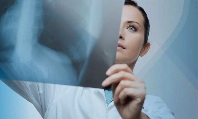 un médico examina una instantánea de la columna cervical con osteocondrosis